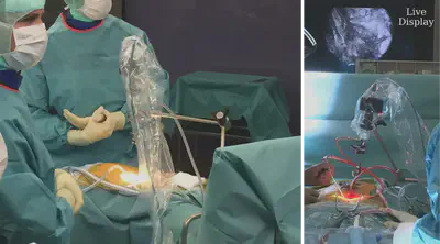 Hyperspectral Imaging (HSI) in the operating room.