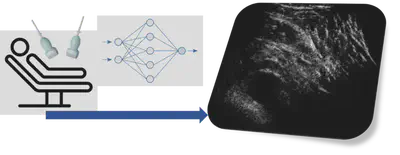 The aim of the project is to develop advanced beamforming techniques to maximise the potential of a hyper-aperture made up of multiple ultrasound transducers. Artificial Intelligent techniques along with ultrasound physics will be used to design acquisition and reconstruction strategies that will lead to superior quality images.