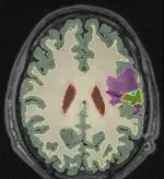 Learning joint Segmentation of Tissues And Brain Lesions (jSTABL) from task-specific hetero-modal domain-shifted datasets