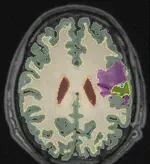 Learning joint Segmentation of Tissues And Brain Lesions (jSTABL) from task-specific hetero-modal domain-shifted datasets