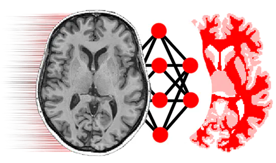 NiftyNet: Open-source convolutional neural networks platform for research in medical image analysis and image-guided therapy