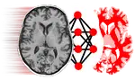 NiftyNet: Open-source convolutional neural networks platform for research in medical image analysis and image-guided therapy