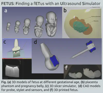 Finding a fETus with an Ultrasound Simulator (FETUS).