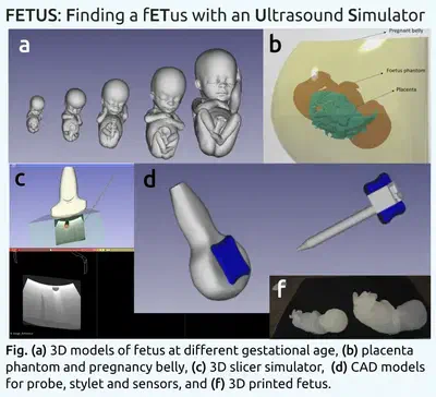 Finding a fETus with an Ultrasound Simulator (FETUS).