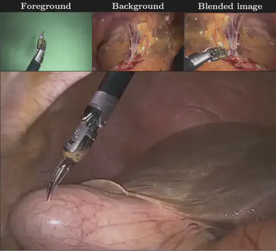 Surgical tool image compositing for machine learning training pipelines ([:book:](https://doi.org/10.1109/tmi.2021.3057884)).