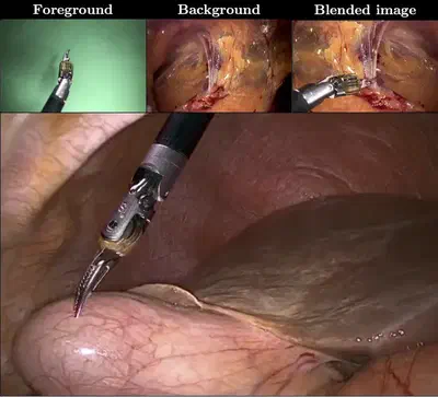 Surgical tool image compositing for machine learning training pipelines ([:book:](https://doi.org/10.1109/tmi.2021.3057884)).