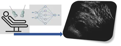 The aim of the project is to develop advanced beamforming techniques to maximise the potential of a hyper-aperture made up of multiple ultrasound transducers. Artificial Intelligent techniques along with ultrasound physics will be used to design acquisition and reconstruction strategies that will lead to superior quality images.