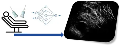 The aim of the project is to develop advanced beamforming techniques to maximise the potential of a hyper-aperture made up of multiple ultrasound transducers. Artificial Intelligent techniques along with ultrasound physics will be used to design acquisition and reconstruction strategies that will lead to superior quality images.