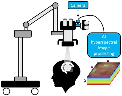 AI-assisted hyperspectral imaging systems for surgical guidance using quantitative fluorescence.