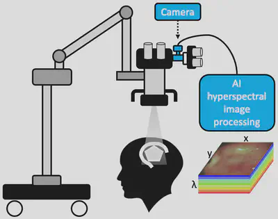 AI-assisted hyperspectral imaging systems for surgical guidance using quantitative fluorescence.