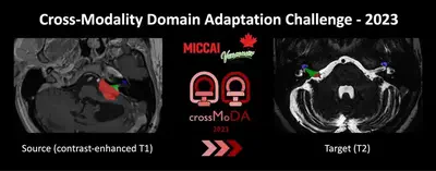 Task: Intra- and extra-meatal vestibular schwannoma and cochlea segmentation.