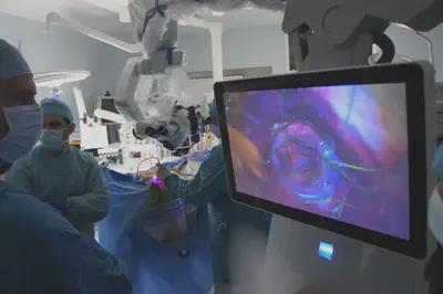 State-of-the-art fluorescence imaging system for neurosurgical guidance.