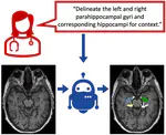 PhD opportunity [October 2024 start] on "Text promptable semantic segmentation of volumetric neuroimaging data"