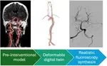 PhD opportunity [October 2026 start] on "Patient-specific CTA-informed in-silico simulation of interventional fluoroscopy: A digital twin for stroke patients"