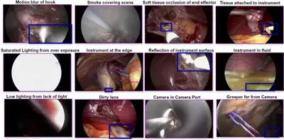 Visual representation of challenging annotation scenarios. Each image highlights a specific hard case: motion blur, smoke, soft tissue occlusion, tissue attachment, saturated lighting, instrument at the edge, reflection, instrument in fluid, low lighting, dirty lens, camera in port, and instrument far from the camera.