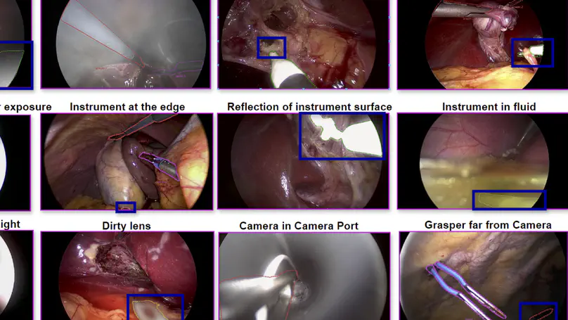 CholecInstanceSeg: A Tool Instance Segmentation Dataset for Laparoscopic Surgery