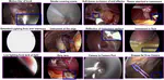 CholecInstanceSeg: A Tool Instance Segmentation Dataset for Laparoscopic Surgery