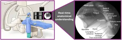 Schematic illustration of an interventional neuroradiologist performing a mechanical thrombectomy procedure with fluoroscopic images being automatically annotated with anatomical landmarks.
