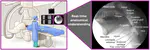 PhD opportunity [February 2026 start] on "Anatomy localisation in X-ray fluoroscopy videos for mechnical thrombectomy" in collaboration with Telos Health