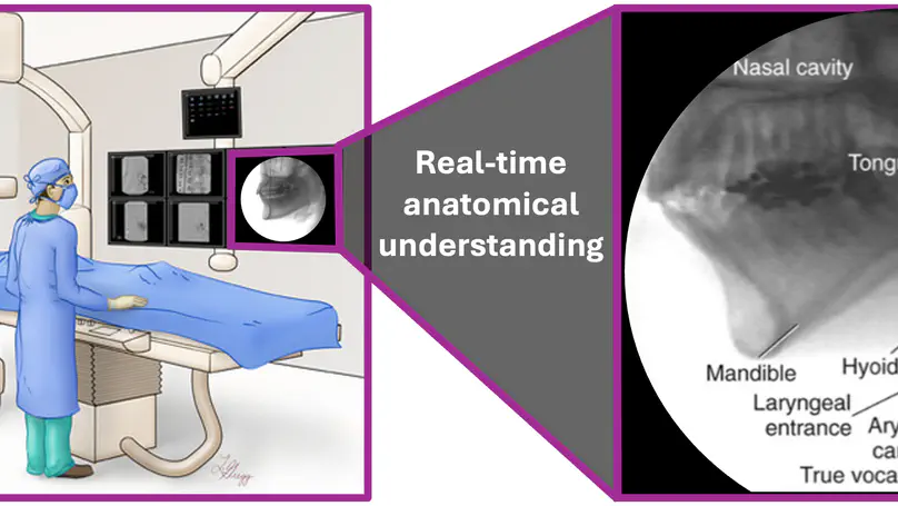PhD opportunity [February 2026 start] on "Anatomy localisation in X-ray fluoroscopy videos for mechnical thrombectomy" in collaboration with Telos Health
