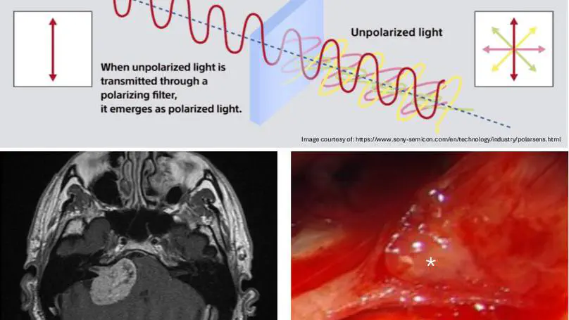 PhD opportunity [October 2026 start] on "Real-time intraoperative polarimetric imaging to detect nerves during brain tumour surgery"