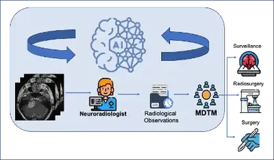 Artificial Intelligence based tool to assist clinicians during multidisciplinary team meetings (MDTMs). A specialist team of clinicians meet to discuss the optimal timing and mode of treatment for patients with brain tumours. This project will develop and evaluate the use of state-of-the-art AI-assisted tools for vestibular schwannoma. The tool will detect and segment the tumours and analyse imaging biomarkers to predict tumour behaviour before and after treatment.