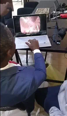 Reviewing laparoscopic surgical video with Professor Adewale Adisa.